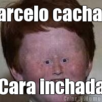 Marcelo cacha�a Cara inchada